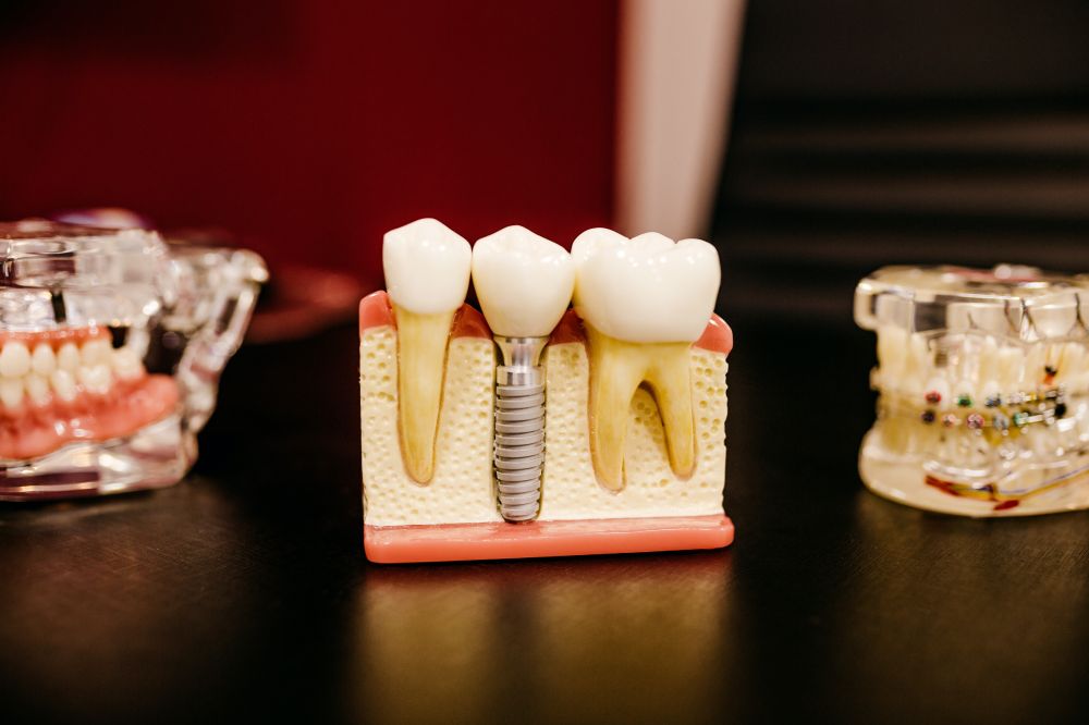 Estetisk tandvård med 3shape